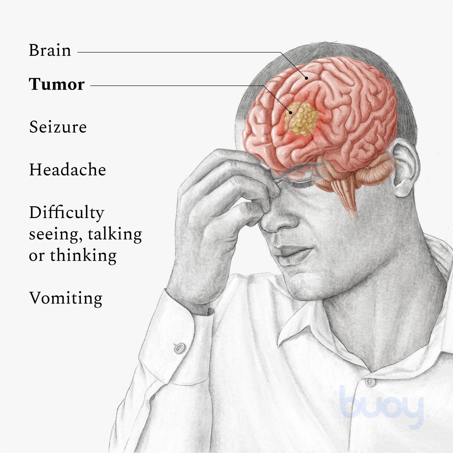 Can You Remove Brain Tumor Without Surgery