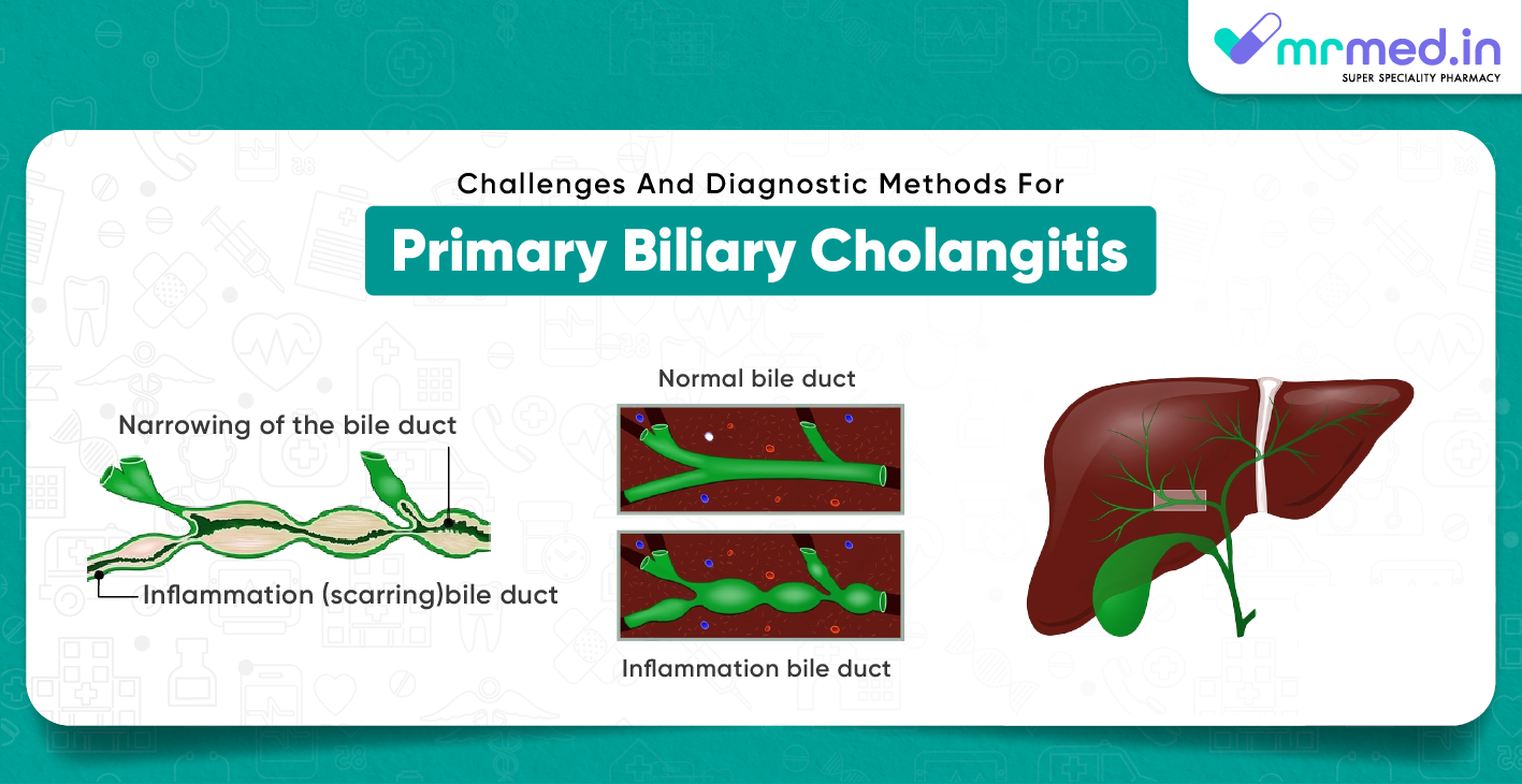 Challenges And Diagnostic Methods For Primary Biliary Cholangitis