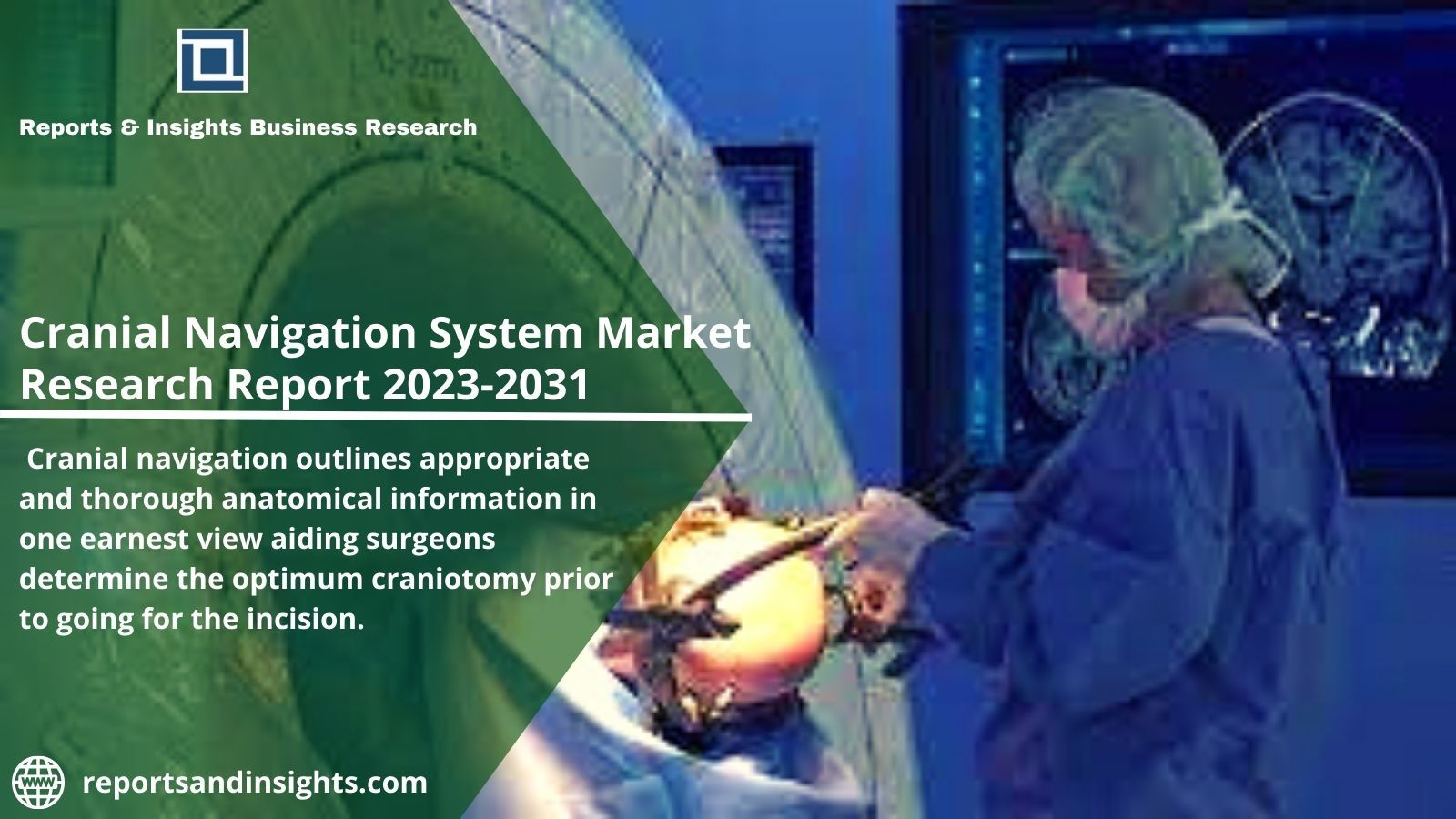 Cranial Navigation Systems Market Trends and Challenges 2023