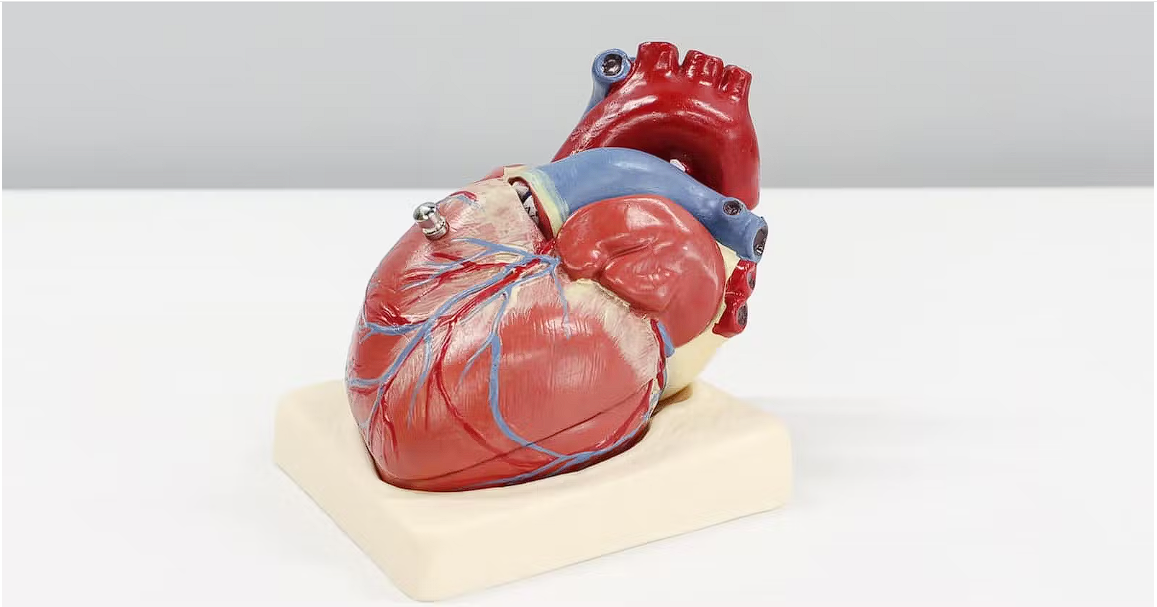 Congenital Heart Disease