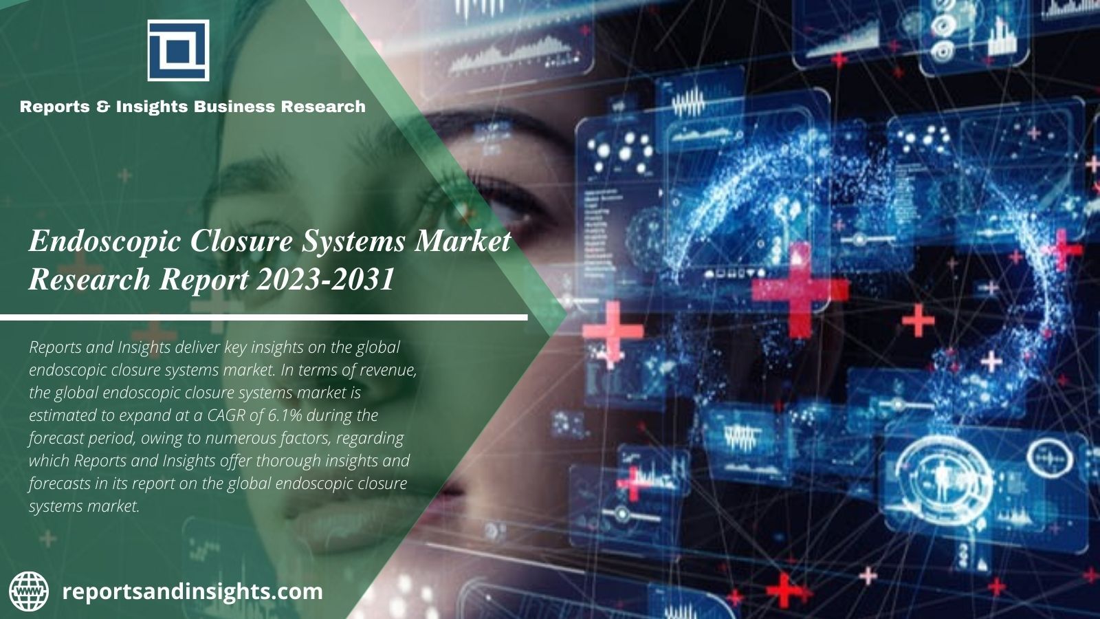 Insights of Endoscopic Closure Systems Market 2023 Cagr of 6.1