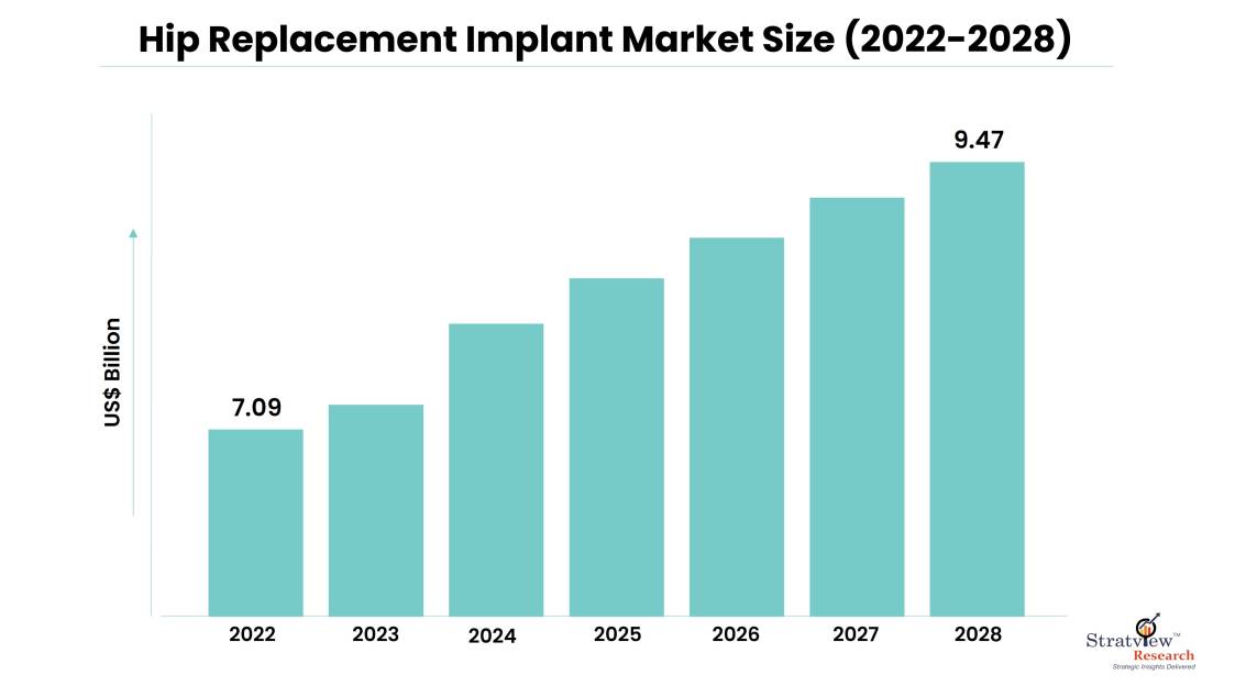 Hip Replacement Implant Market Size