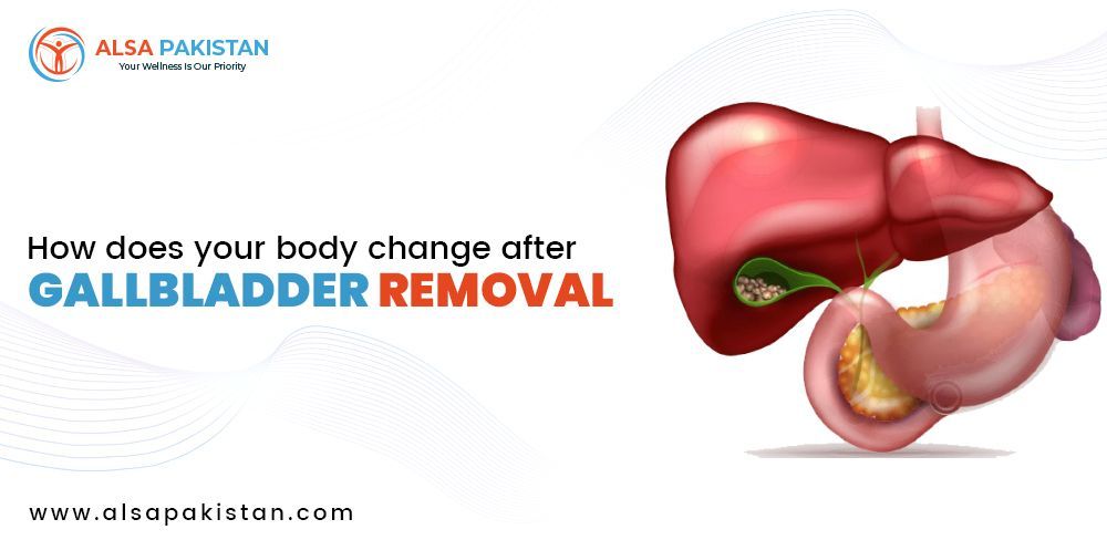 How Does Your Body Change After Gallbladder Removal   How Does Your Body Change After Gallbladder Removal 3c92d19f88 