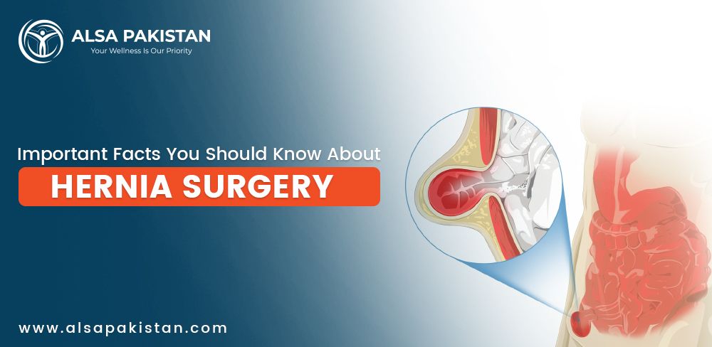 Top Laparoscopic Hernia Surgeons In Pakistan