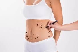 Liposuction surgery in Dubai offers a transformative solution for individuals seeking to reshape their bodies by removing stubborn fat deposits that resist diet and exercise