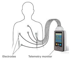 Mobile Cardiac Telemetry Monitors Market Overview: Industry