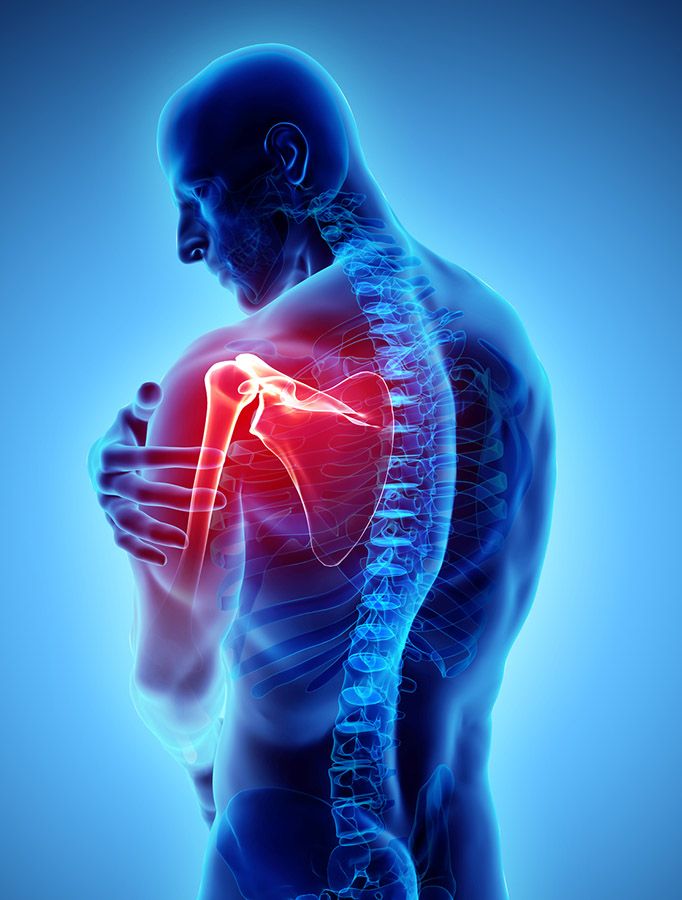 Understanding The Roots Of Your Muscle Pain And What To Do