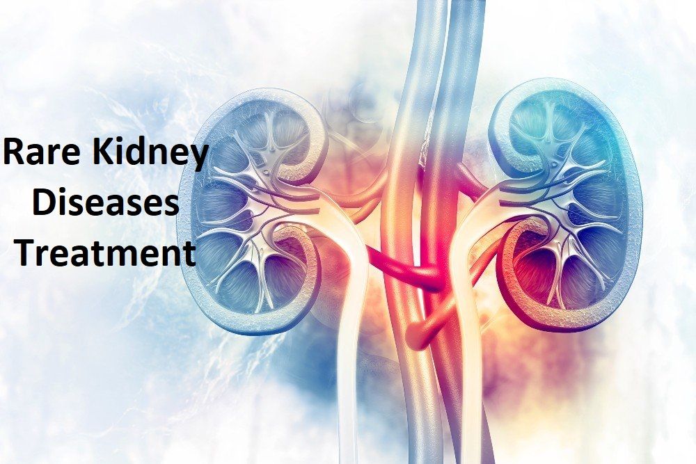 Rare Kidney Diseases Treatment Market Report Trends Forecast 2028