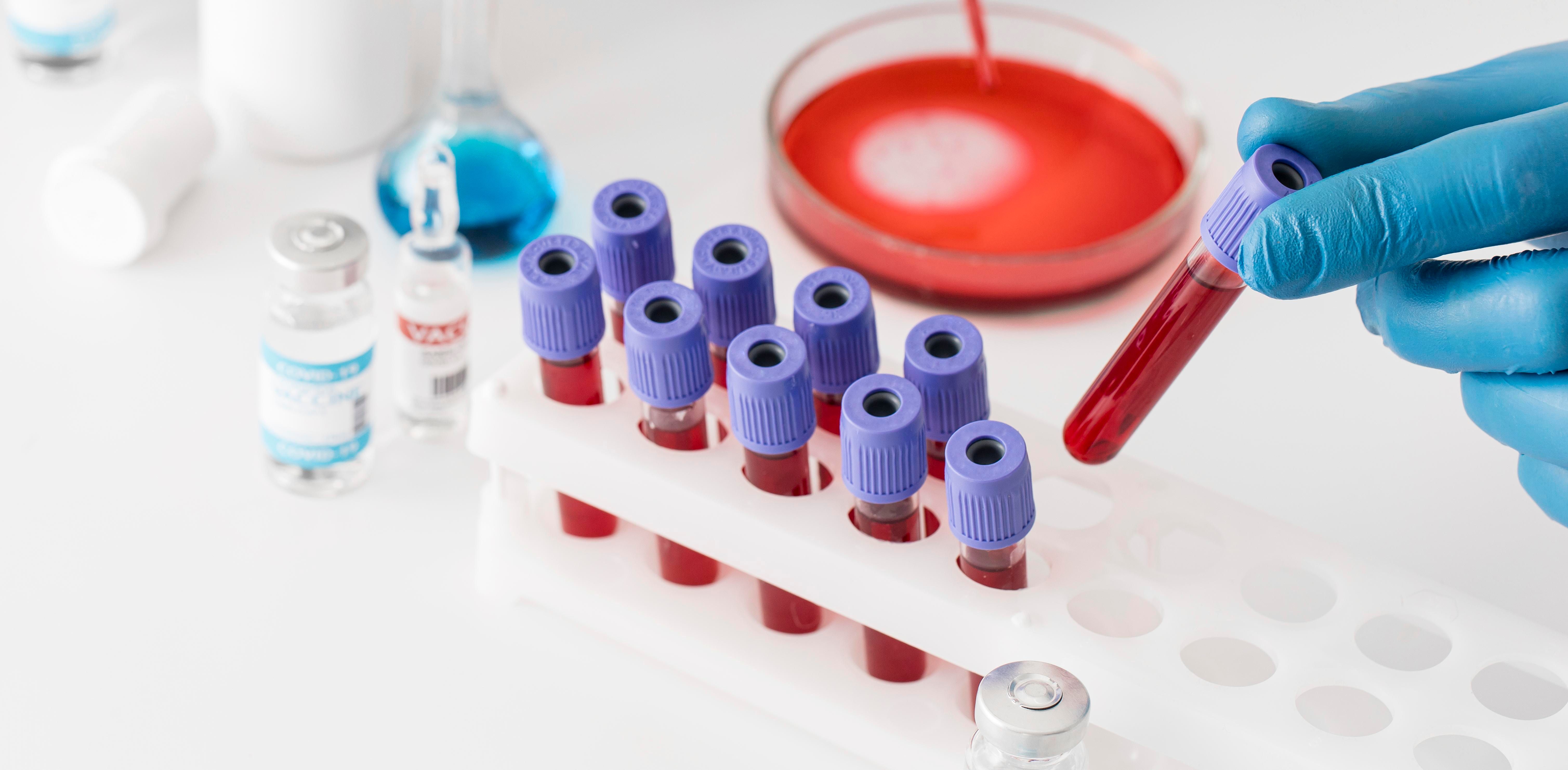 Global Blood Collection Tubes Market Forecaste 20232030