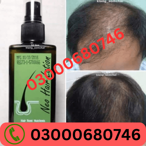Neo Hair Lotion PRICe in  03000680746