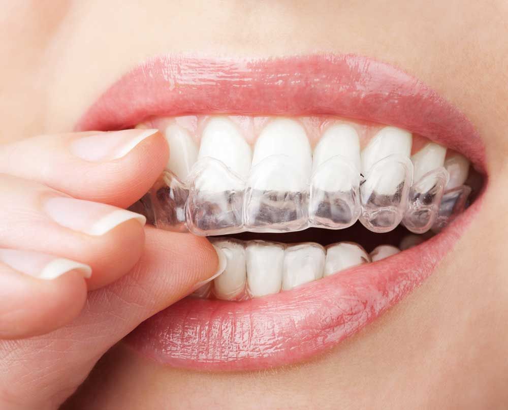 Why Do We Need Cosmetic Dentist?