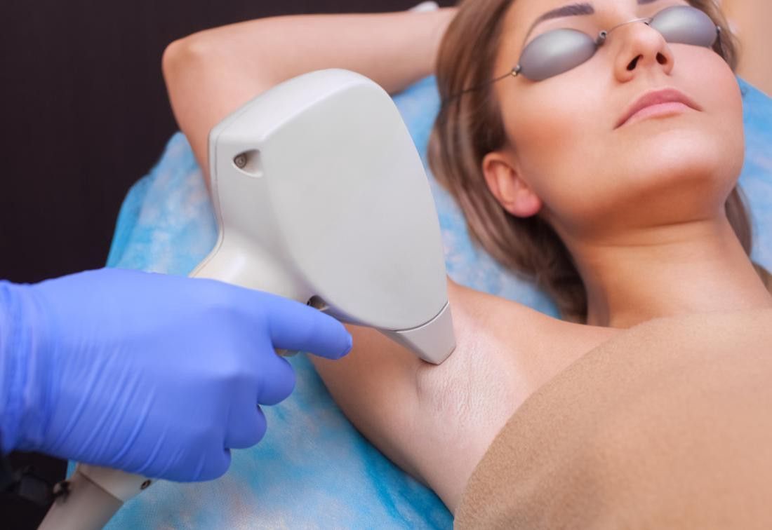 Laser Hair Removal in Orlando: A Review of Available Treatments