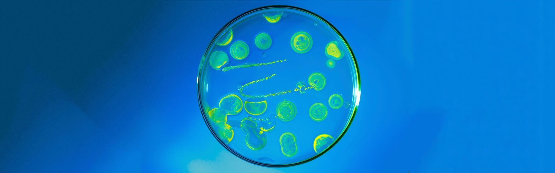 Anti-Infectives Market Worth Us$ 180.25 Billion by 2027