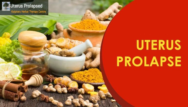 Uterine Prolapse – What’s Everything You Need to Know?