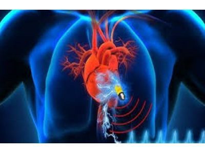 Active Implantable Devices Market: Analysis, Size, Share 2030