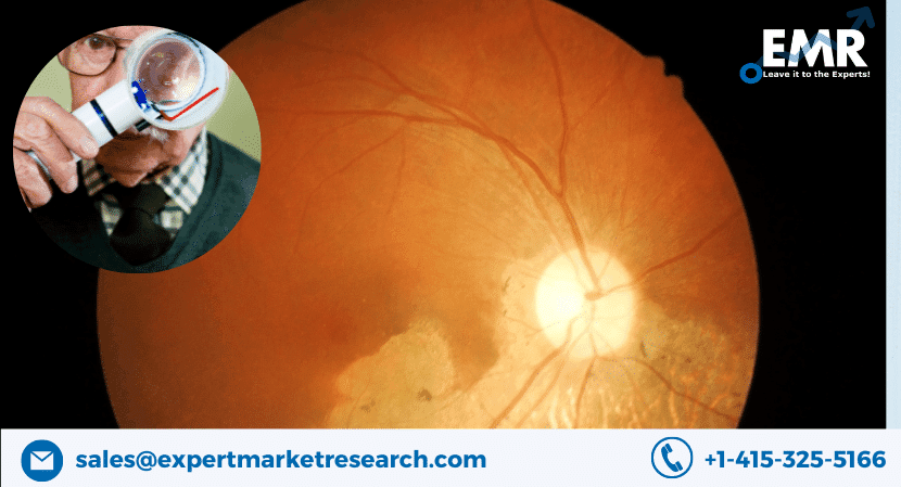 Age-Related Macular Degeneration Market Size and Industry Growth