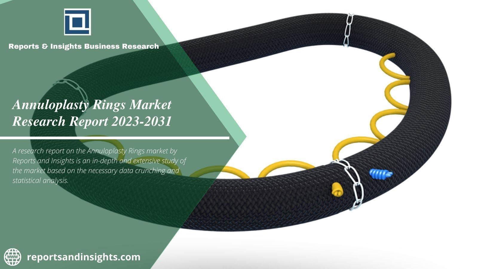 Annuloplasty Rings Market Trends, Growth & Future Outlook, Trends