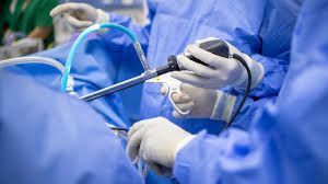 Arthroscopy Devices Market Trends, Size & Forecast Report to 2028