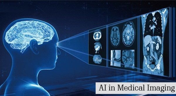 Artificial Intelligence in Medical Imaging Market Report 2028
