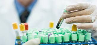 Autoimmune Disease Diagnostics Market Size, Forecast to 2028
