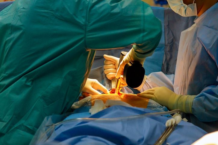 Bariatric Surgery Side Effects You Should Know