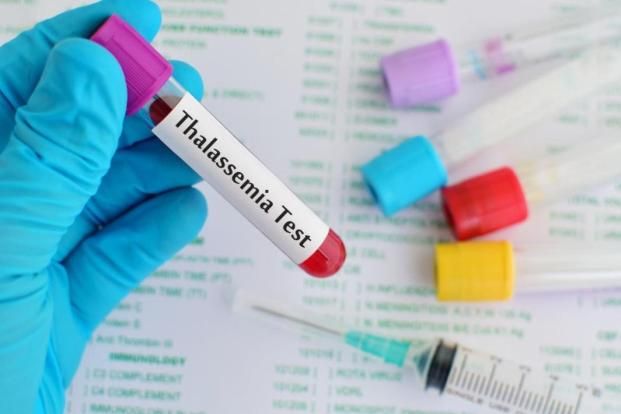 Beta Thalassemia Testing Market Report Industry Opportunity 2028
