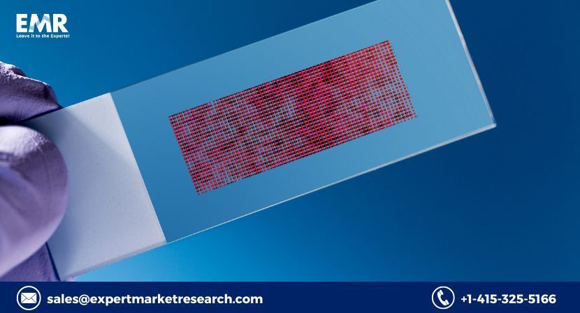 Biochips Based In-Vitro Diagnostics Market Price, 2022-2027 Emr