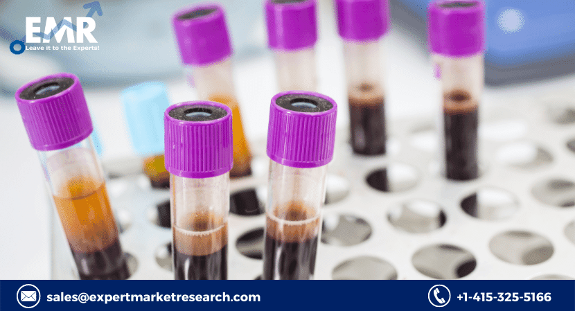 Global Blood Collection Market Size, Analysis and Industry Growth