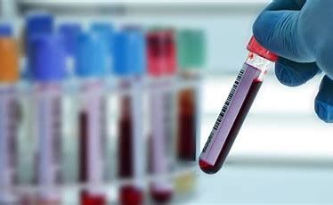 Blood/iv Warmers Market 2022 - Top Key Players Report Till 2028