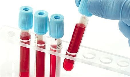 Blood Screening Market 2022 | Industry Demand and Forecast 2028