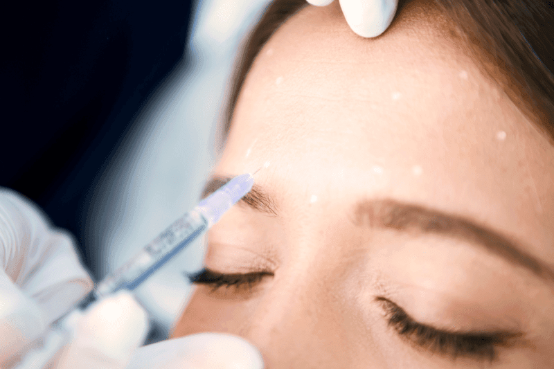 Botox Injections for Forehead Lines and More