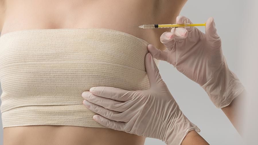 Do Reduced Breasts Grow Back?