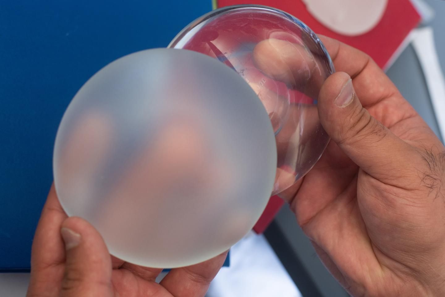 Breast Implants Market 
Size, Report & Forecast to 2028
