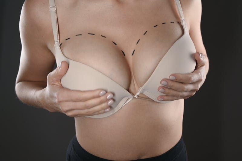 Breast Reduction vs. Breast Lift: Key Differences