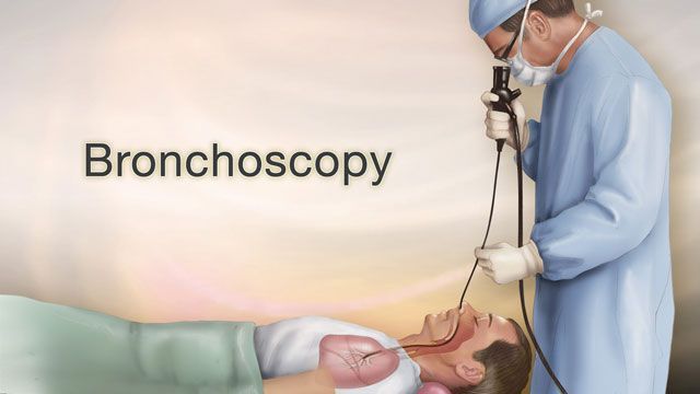 Bronchoscopy Market Status, Growth | Industry Analysis Report