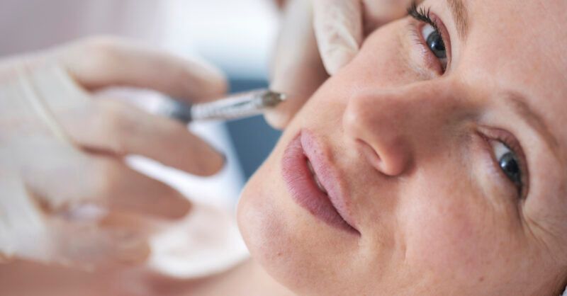 Look Youthful and Radiant Everyday Using Juvederm Fillers