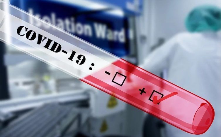 Covid-19 Antibody Detection Kit Market Forecast Report to 2028