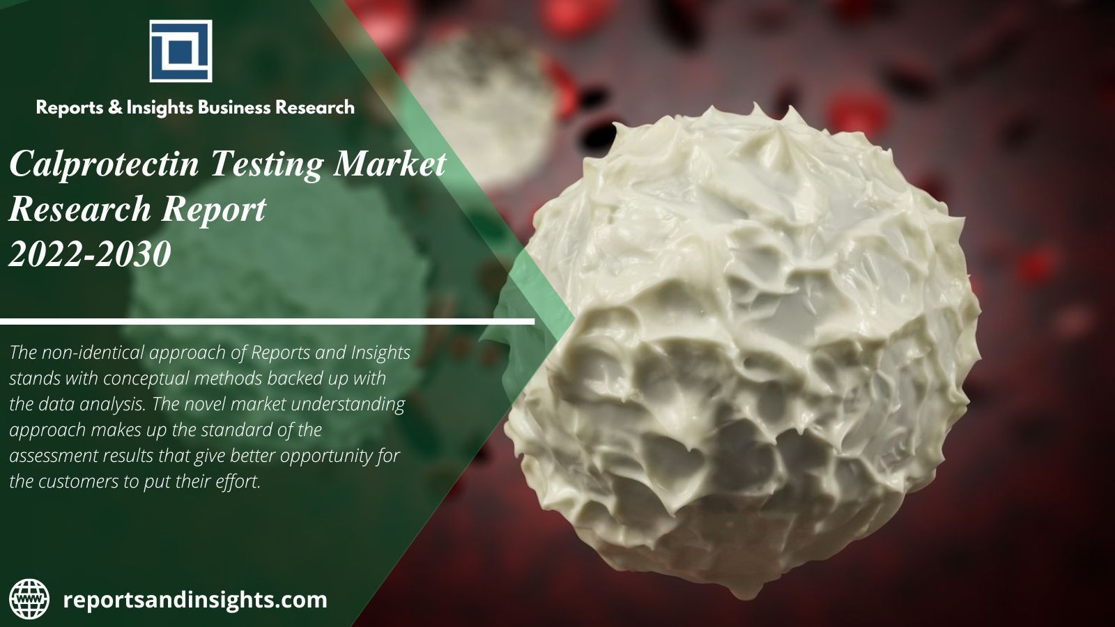 Calprotectin Testing Market Share, Upcoming Trends, Size 2030 R&i