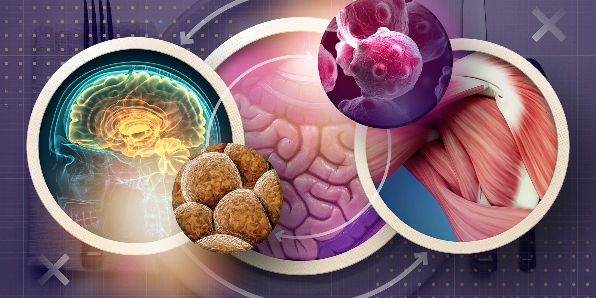 Cancer Cachexia Market Share, Revenue & Growth Analysis Report 
