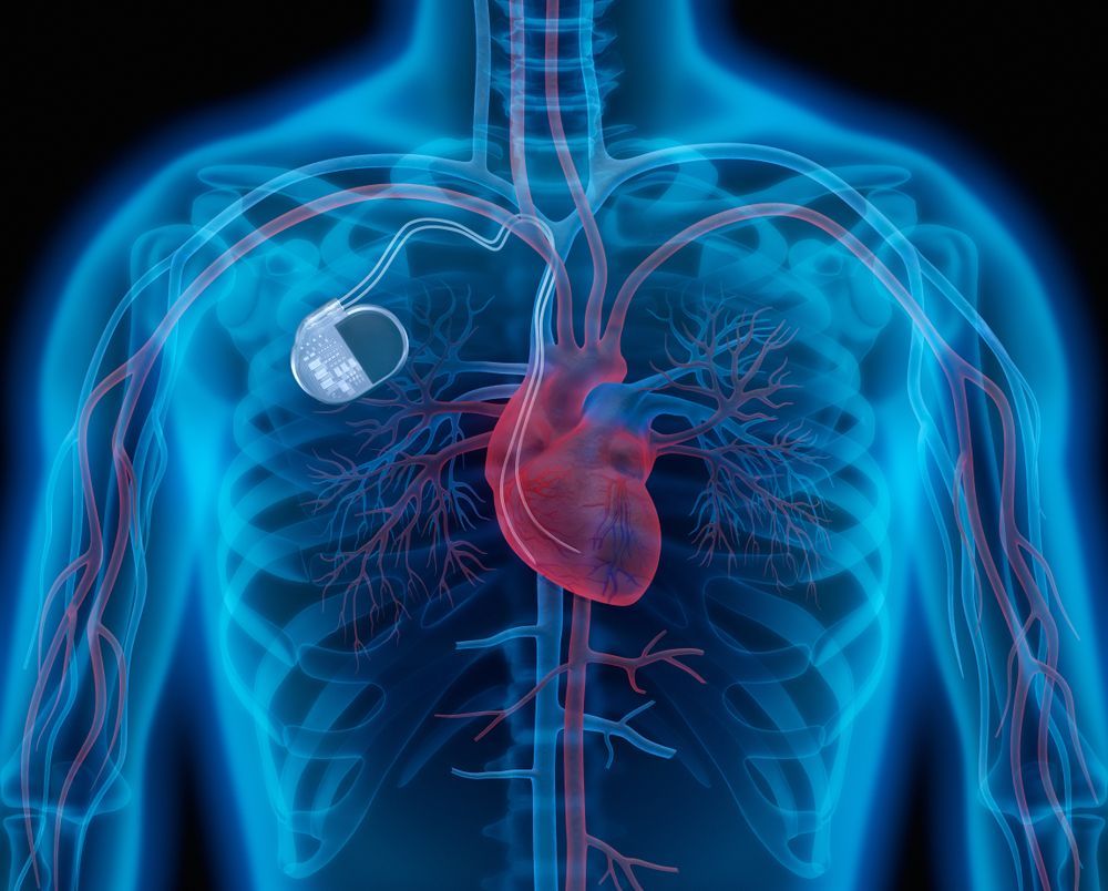 Cardiac Assist Devices Market Dynamics & Forecast Report to 2028