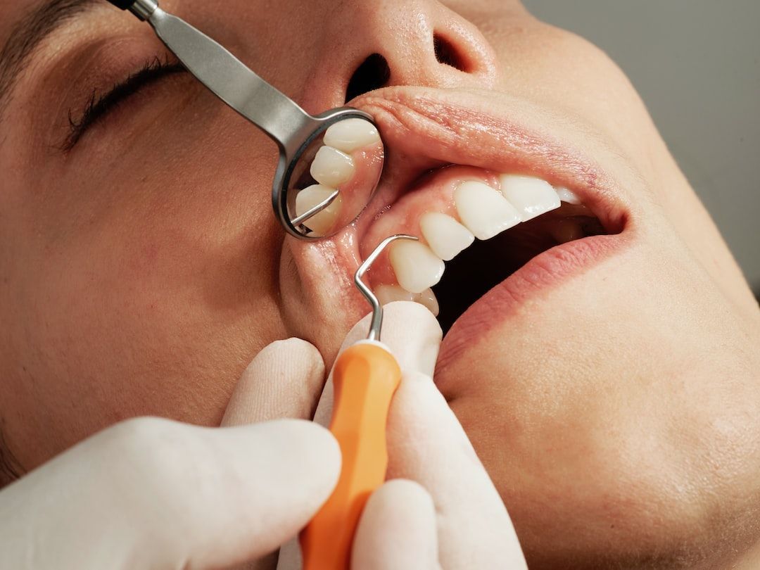Cosmetic Dentist Los Angeles: Everything You Need to Know