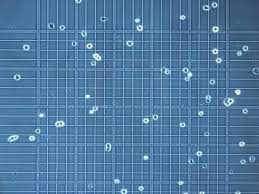 Cell Counting Market Size & Share Report, 2021–2028