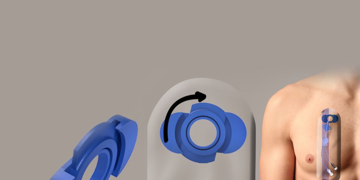 Why Central Venous Catheter Protection Matters More Than You Think