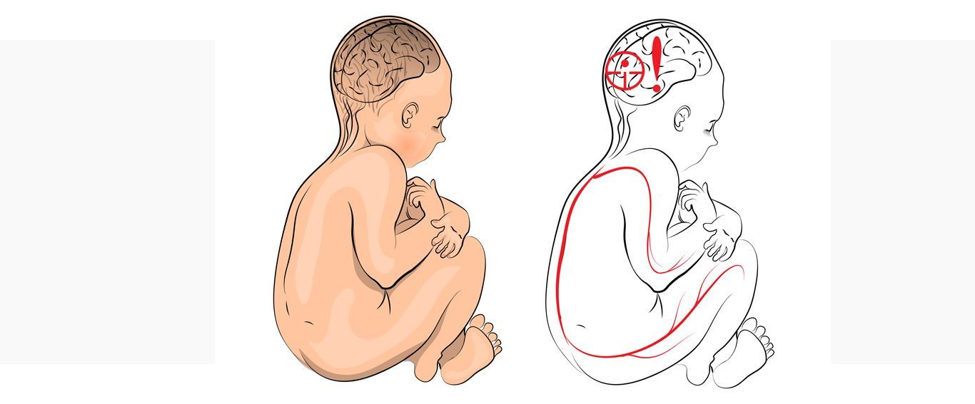 Learn About Various Cerebral Palsy Treatment Choices