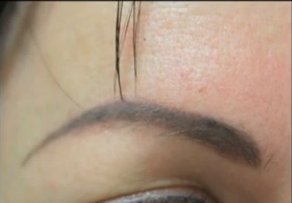 Change Your Look with Eyebrow Hair Transplant Methods