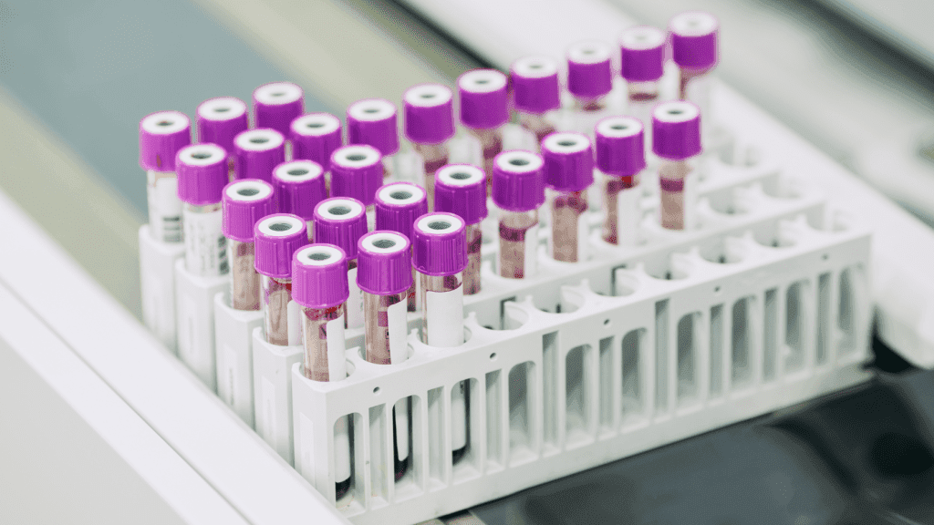 How Accurate Are Candida Tests?
