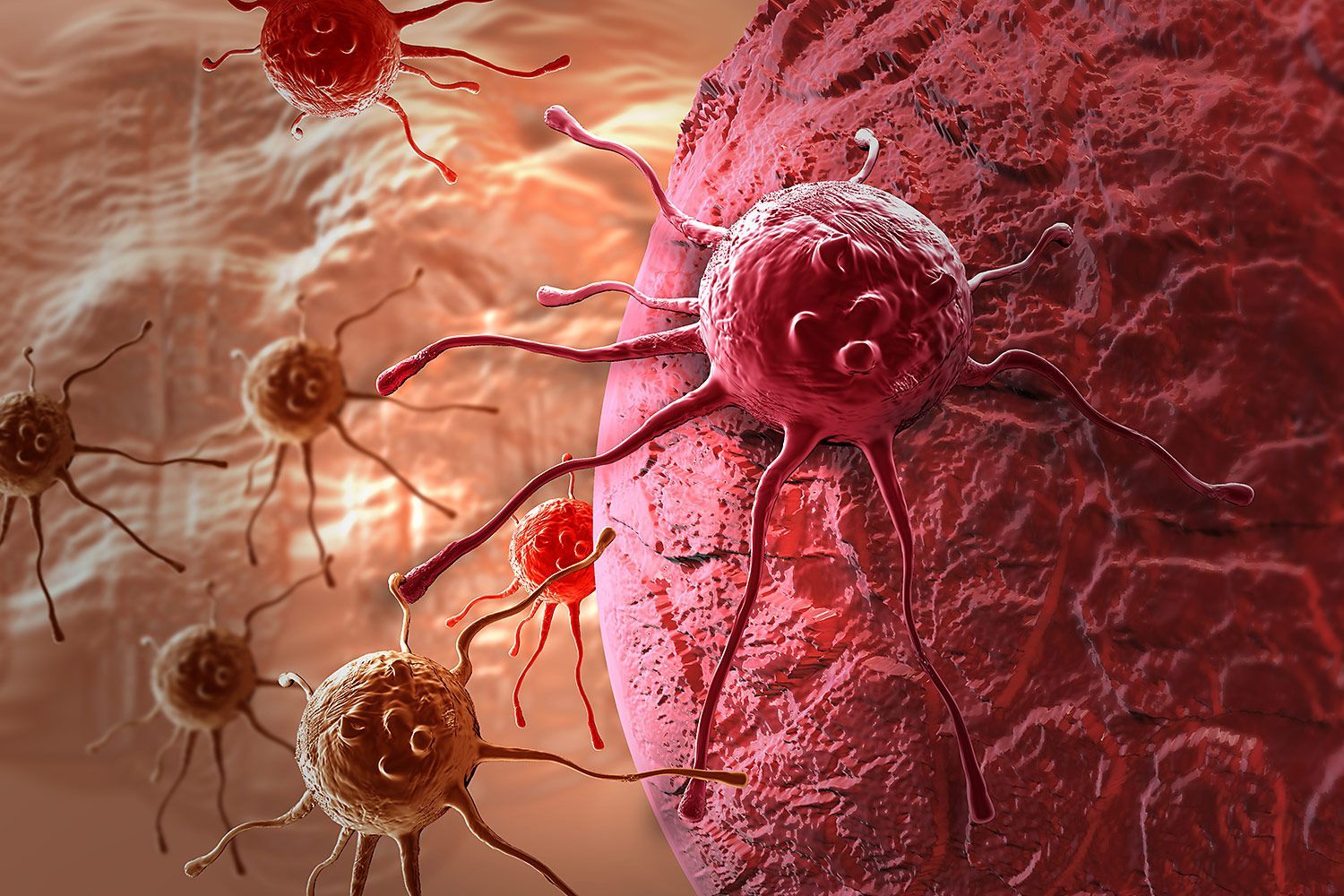 Checkpoint Inhibitor Refractory Cancer Market Size Report to 2028