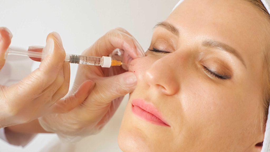 Cheek Fillers | Procedure, Cost, Side Effects – Secondlook