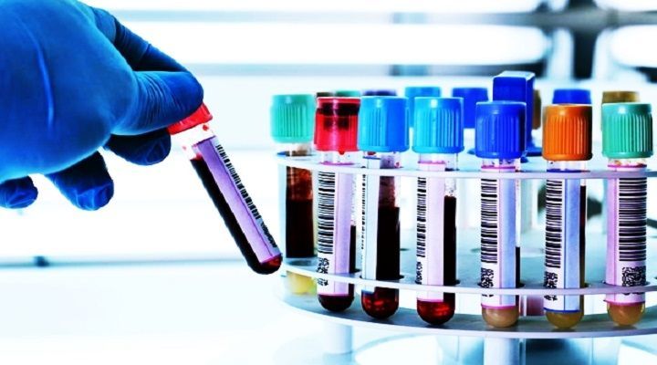 Clinical Laboratory Services Market Trends & Share Report to 2028