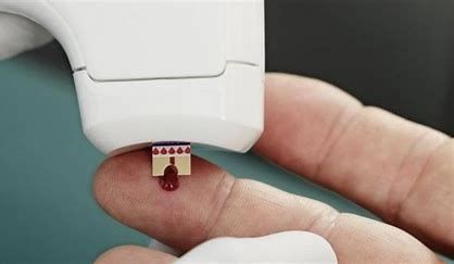 Portable Blood Gas Analyzers Market Forecast Report to 2028